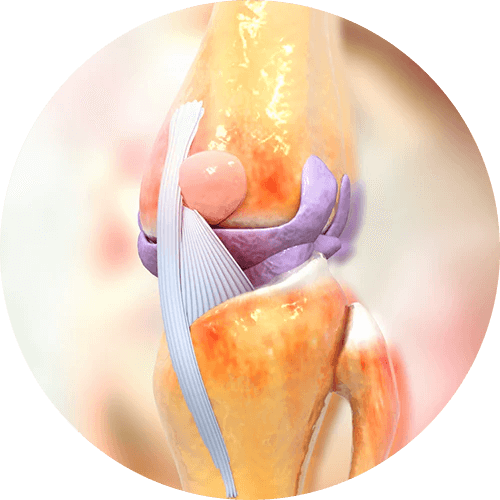 Acción regeneradora